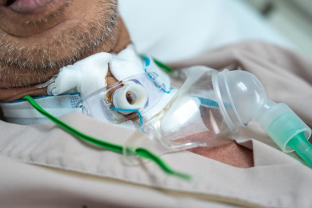 A patient who has undergone a tracheotomy for intubation.